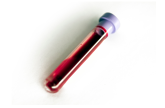 biomarker-1